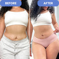 SONIQ - Body Contouring Device