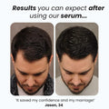 Advanced Hair Growth Roll-On Serum
