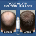 Advanced Hair Growth Roll-On Serum