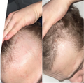 Advanced Hair Growth Roll-On Serum