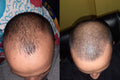 Advanced Hair Growth Roll-On Serum